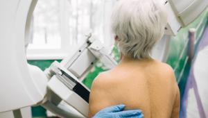 一位年长的妇女站在乳房x光机前，准备进行扫描